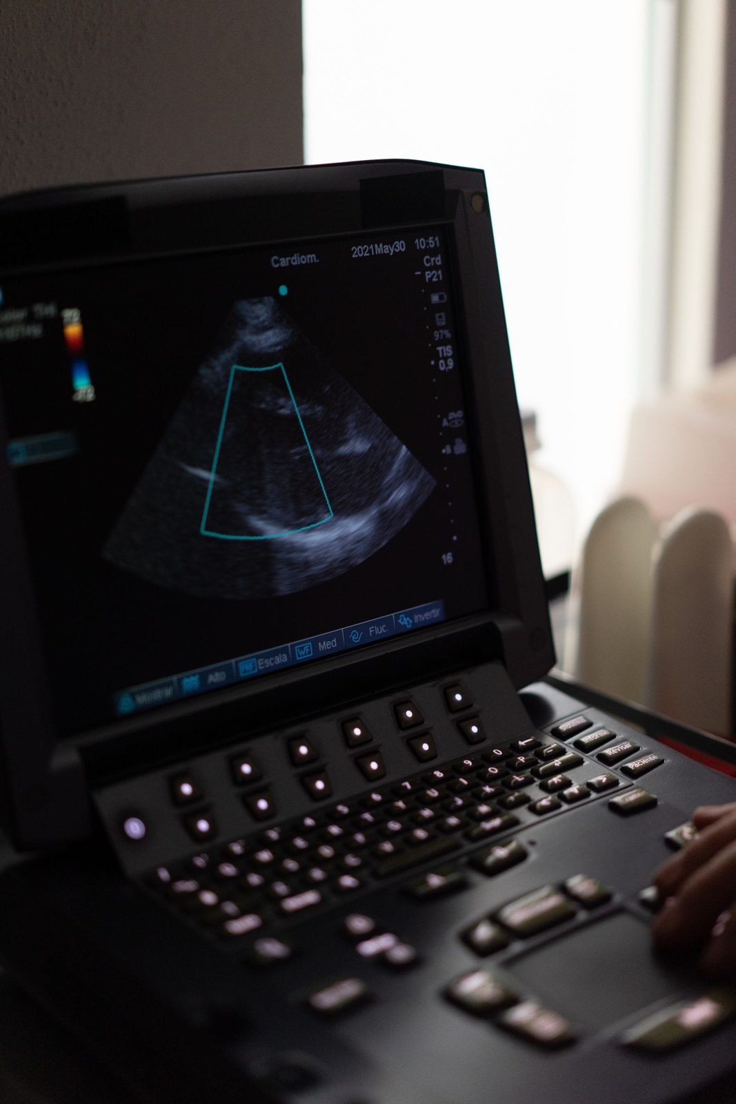 Aparelho de ultrassom com Doppler
